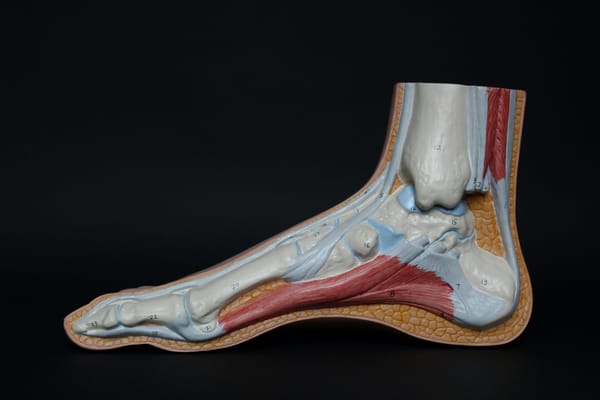 Running with plantar fasciitis: all the pain and limited gain